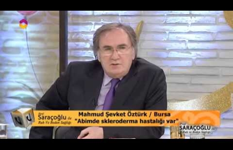 Skleroderma İçin Kür